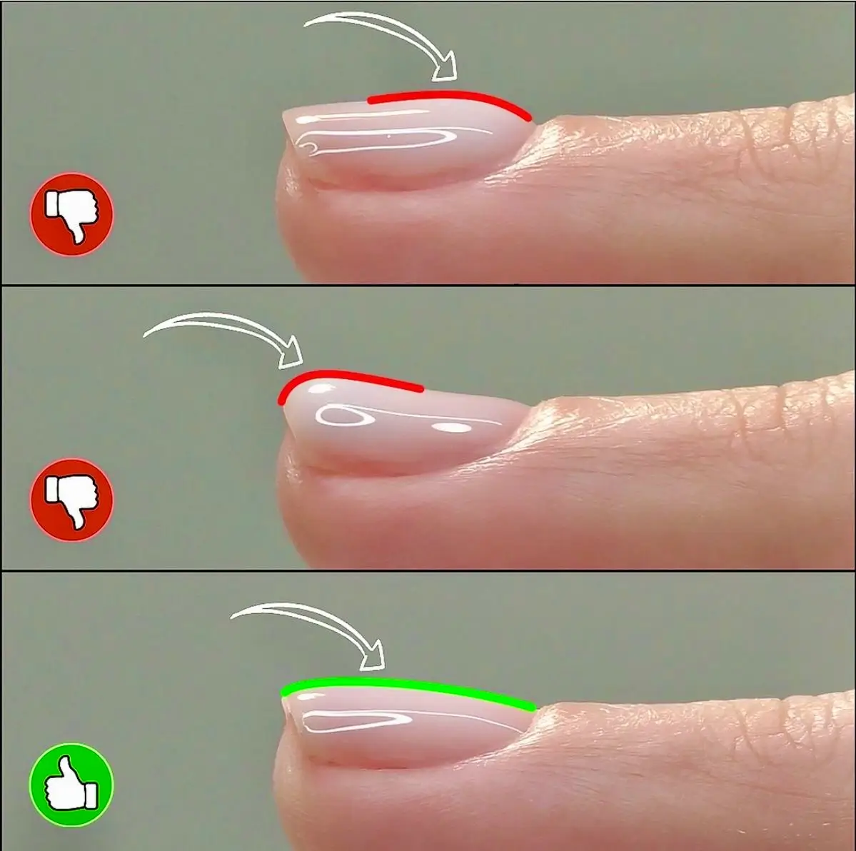 5 Fast Ways for Nail Length Growth